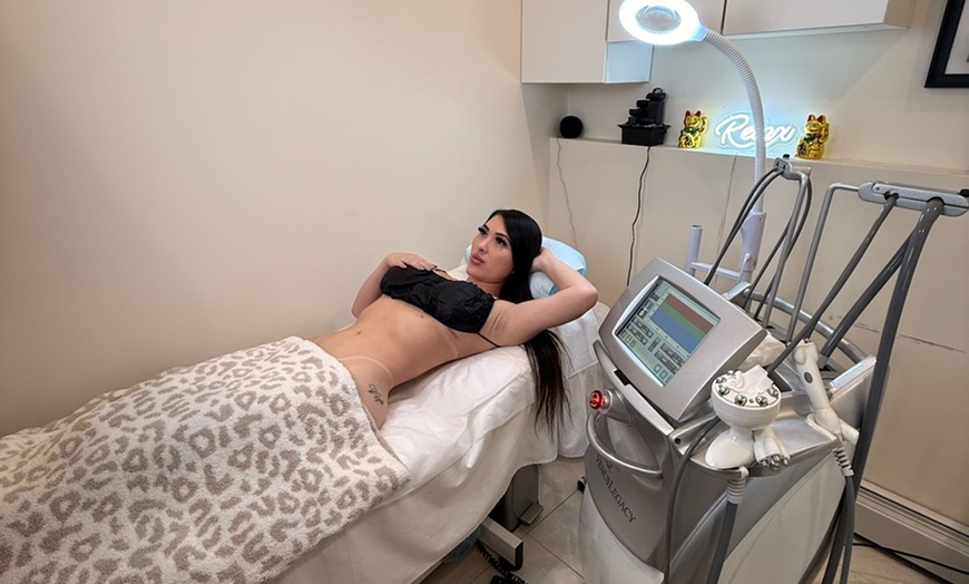 Image 2: 3 or 5 Sessions of Venus Legacy Luxury Radio Frequency Skin Tightening