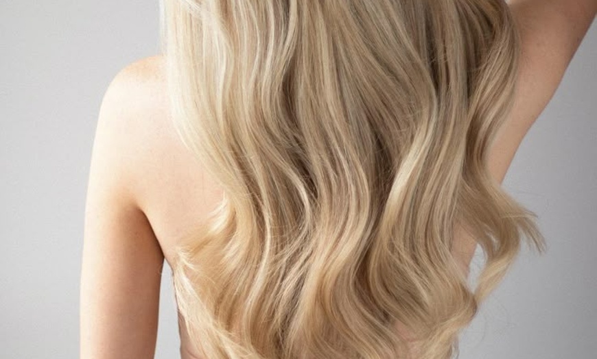 Image 1: Regrow & Revitalize: Up to 47% Off PRP Hair Restoration 

