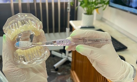 Higiene bucal con pulido dental, revisión y limpieza profunda de encías en 1 cuadrante con fluor - Clínica Dental Dr Ahmad Youssef