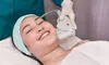 MedSpa Solutions Offers CoolPeel CO₂ Laser Treatment for Face w/w/o Neck to Improve Tone - Up To 47% Off