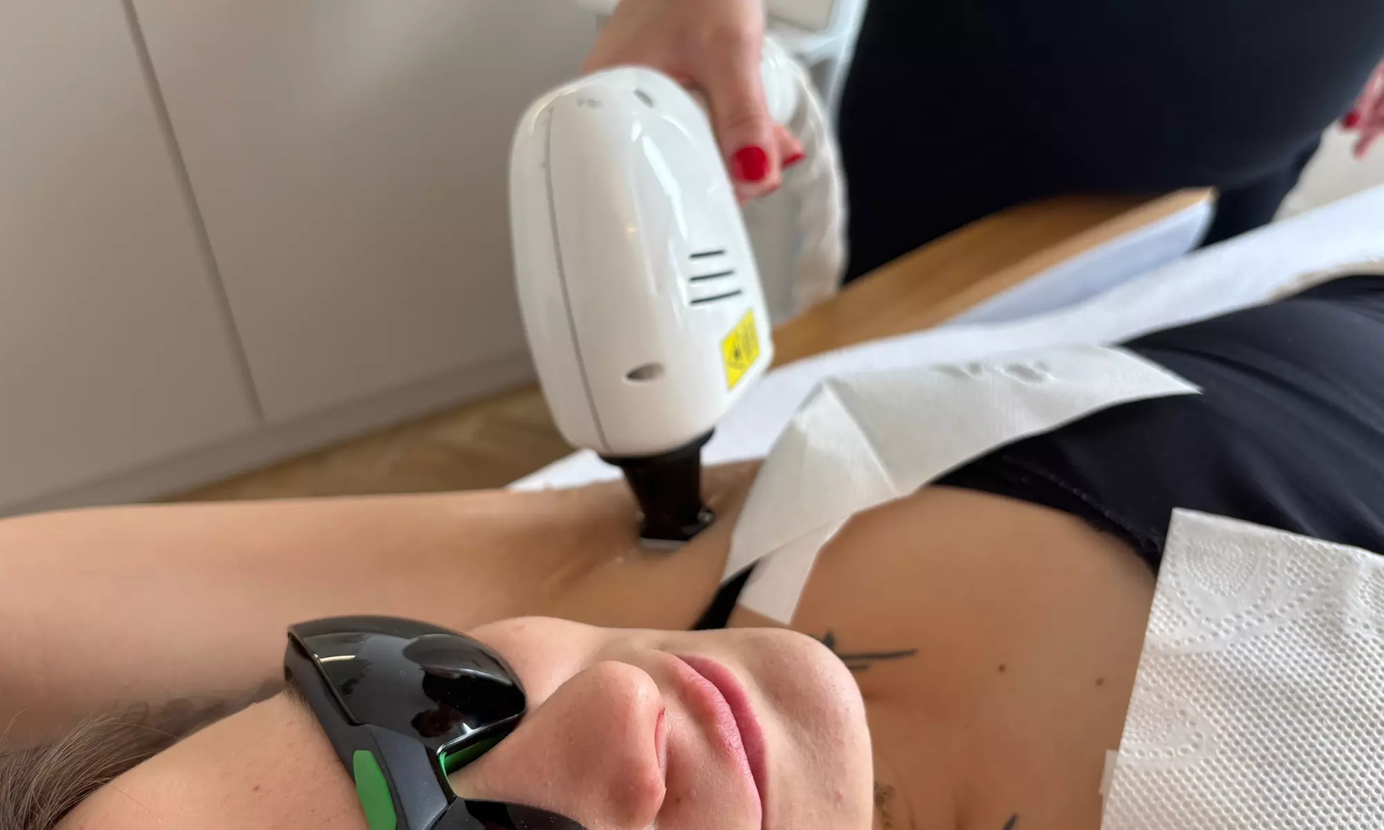 Depilacja laserowa wybranej partii ciała – 1 lub 3 zabiegi