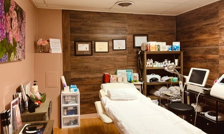 One IPL Photofacial - LASER SCULPTURE CENTER