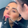Image 4: Lip Filler and Enhancement Options Using Evolysse