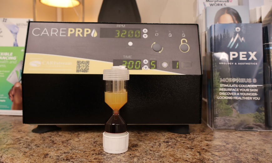 Image 7: Glow, Lift, And Renew With Laser Genesis, RF, PRP, And Tone Sessions