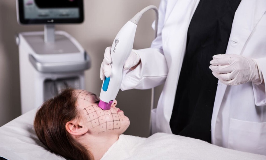 Image 1: Up to 20% Off on Radio Frequency Skin Tightening at Noble Essentials Day Spa & Wellness