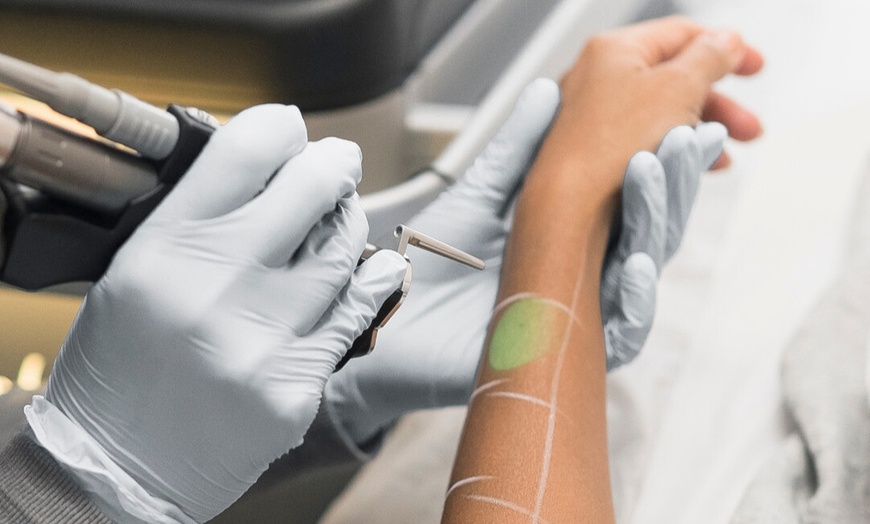 Image 4: Smooth, Hair-Free Skin with Laser Hair Removal at Bared Monkey