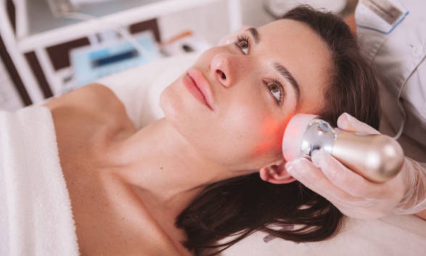 Image 4: Hollywood peeling con carbón activo y láser o limpieza facial prémium 