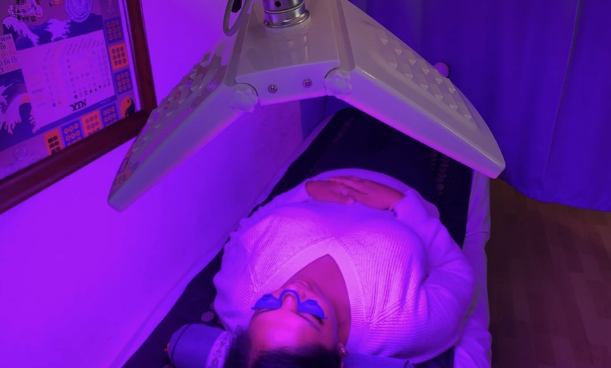 Image 3: Up to 45% Off on Facelift - Non-Surgical at Violet Wellness Spa by Tian Chao Herbs and Acupuncture