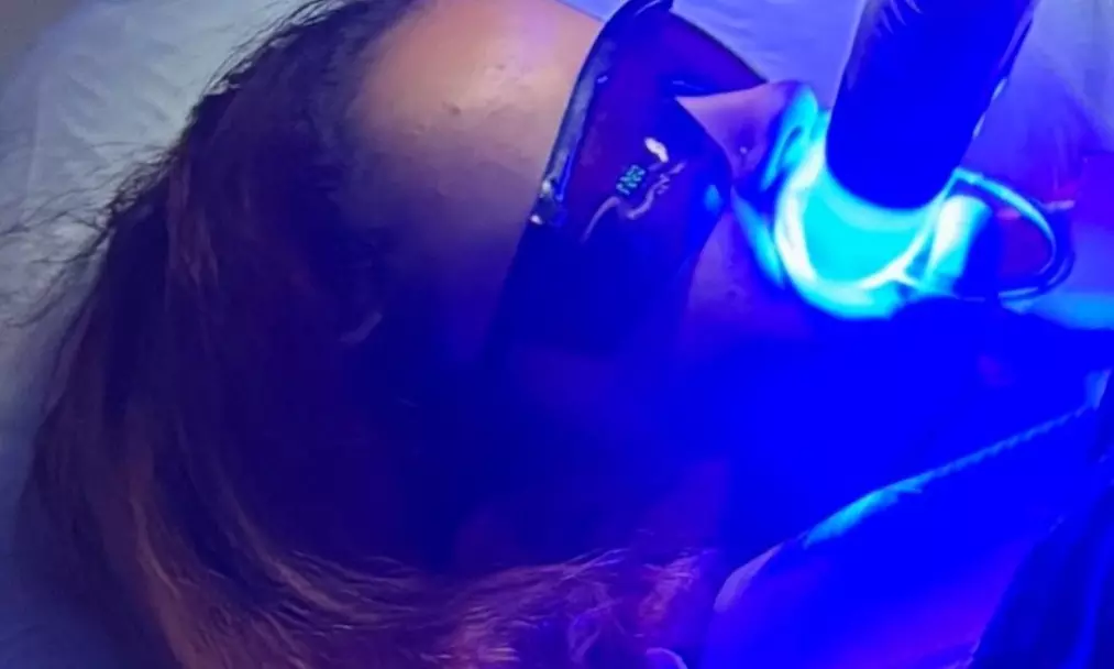 Teeth Whitening Sessions for a Radiantly Brighter Smile 