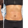 Image 2: Try body sculpting and velashape for cellulite reduction