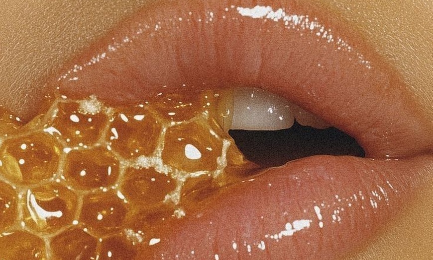 Image 6: 0.5 ML, 1 ML or 2 ML For Lip or Chin or Cheek with Consultation