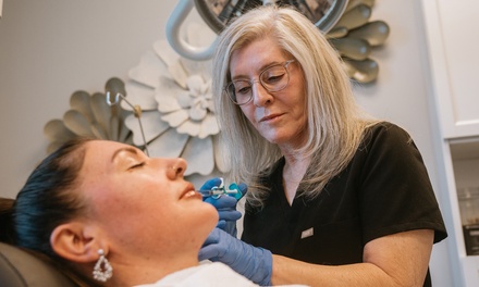 Half Syringe of Versa Lip Filler - Viona Medical Spa