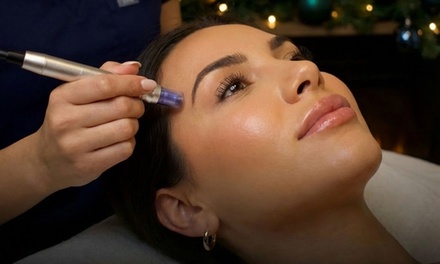 One Micro-Needling Treatment - Body Balance Medical