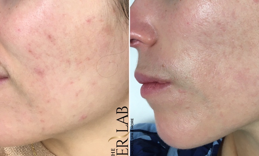 Image 2: Rejuvenate Mom’s Glow: Up to 75% at The Laser Lab