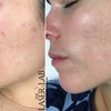 Image 2: Rejuvenate Mom’s Glow: Up to 75% at The Laser Lab