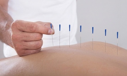 One 60 Minute Acupuncture Session - Thumb Acupuncture