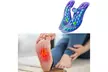 Acupressure Arch Support Insoles with Magnetic Stimulation From Ever Mercantile (Up to 68% Off); Free Shipping - Image 5