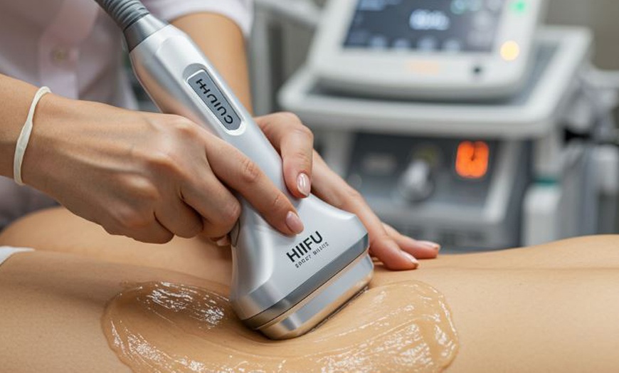 Image 2: 1 sesión de tratamiento reductor sin cirugía y sin dolor 