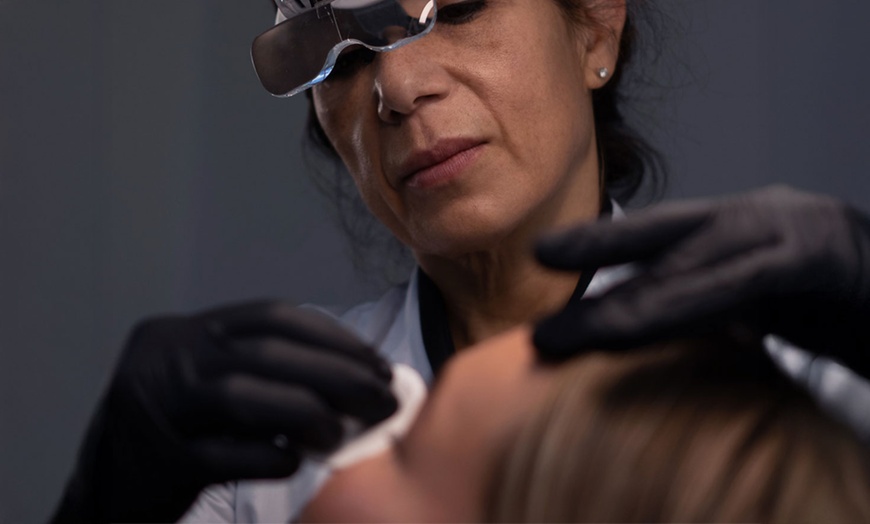 Image 3: Professionele botoxbehandelingen voor een verzorgde uitstraling