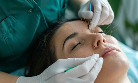Acupuncture - Freya Center