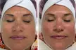 Hydrafacial Glow & Lashlifting bij Beauty Clinic by Nouha - Image 5