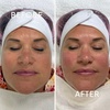Image 5: Hydrafacial Glow & Lashlifting bij Beauty Clinic by Nouha