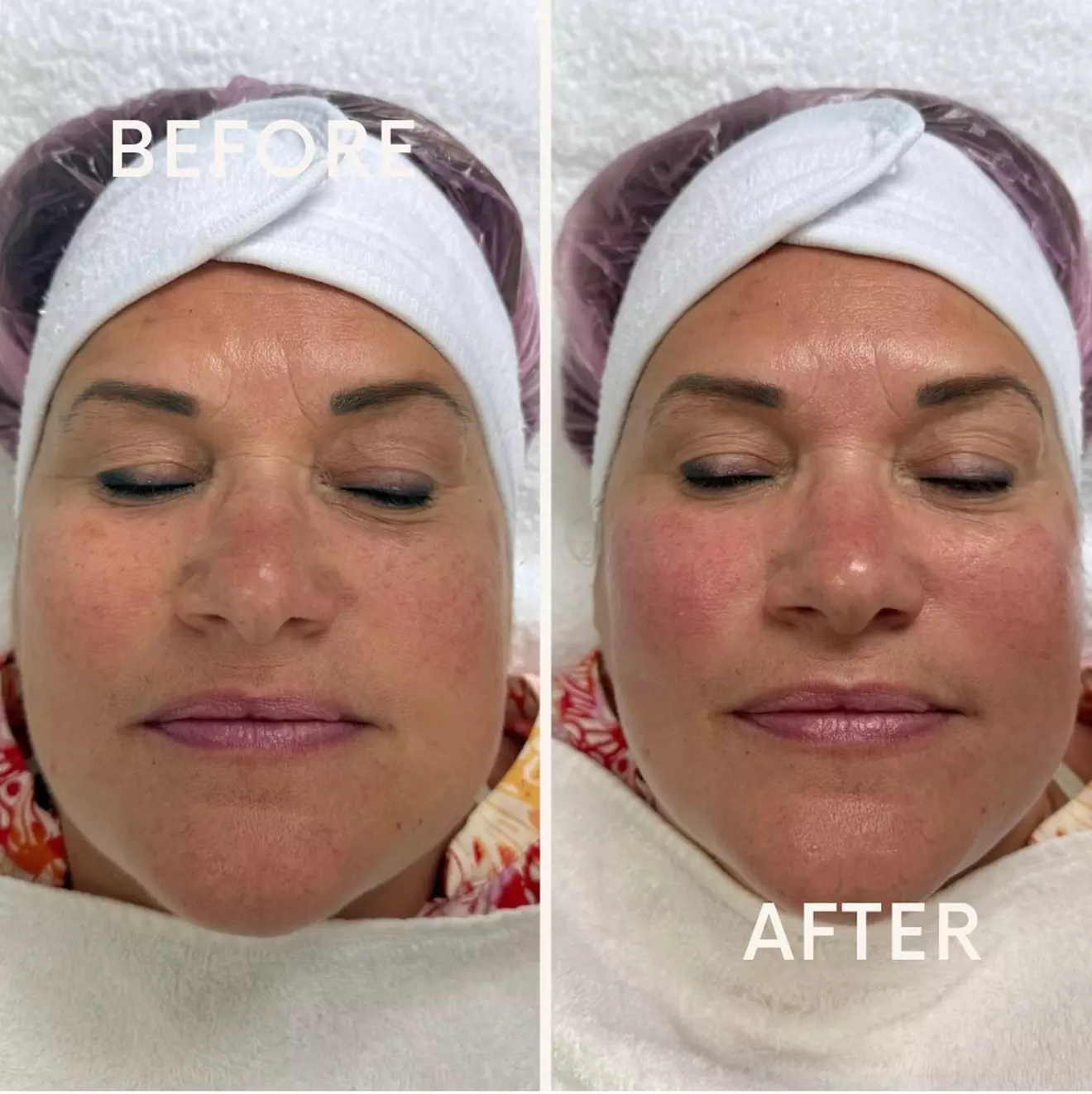 Hydrafacial Glow & Lashlifting bij Beauty Clinic by Nouha