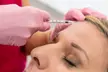 Up to 46% off Botox at Skin Social - Second Medium