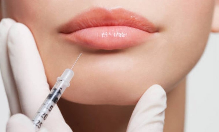 Image 7: Infiltración de 1 o 2 viales de relleno dérmico y opción a mesoterapia 