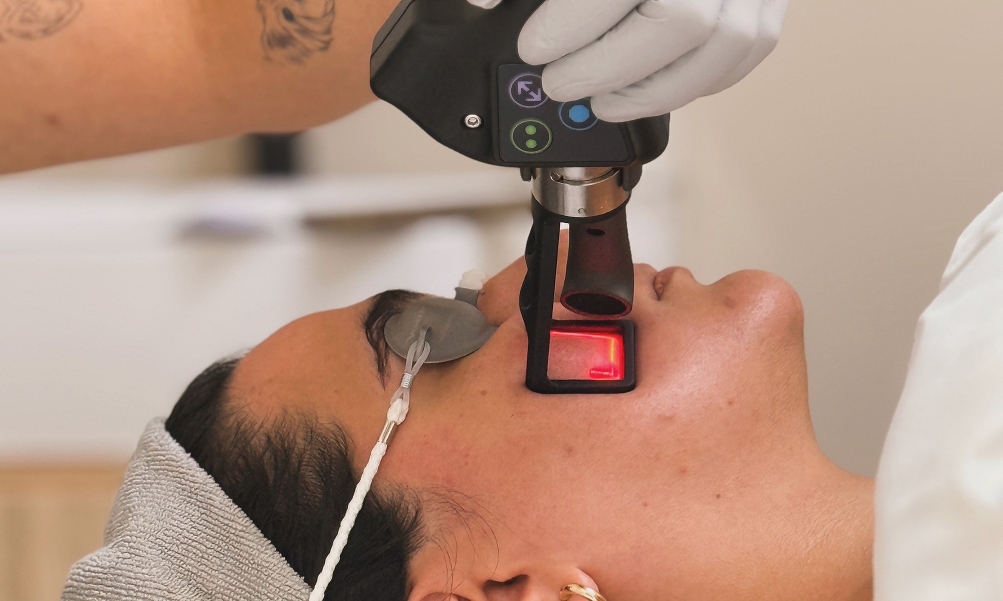 Transform Your Look: CO2 Laser Skin Rejuvenation - Face, Neck,& Chest