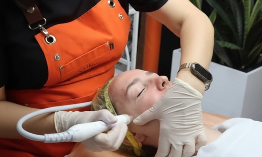 Image 2: Limpieza facial: ultrasonidos, mascarilla, radiofrecuencia o peeling
