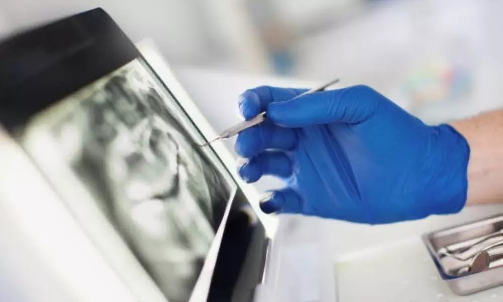 Dental Exam, Teeth Whitening, Membership, X-ray/Implant Package & More