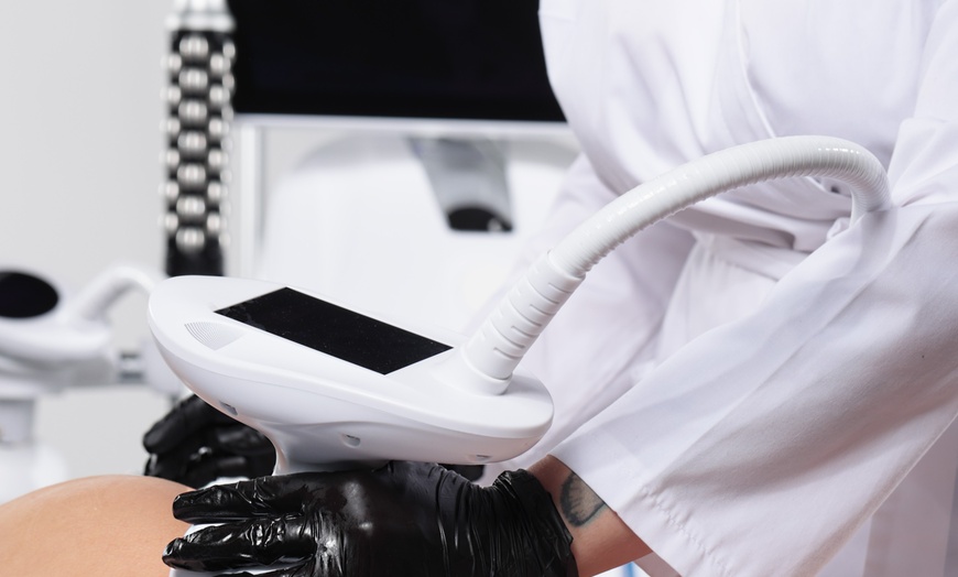 Image 4: Zabiegi na platformie ENDO z rolkami sferycznymi na wybrane partie