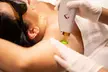 Up to 90% Off on Laser Hair Removal at Gentle Zap Laser Med Spa - Second Medium