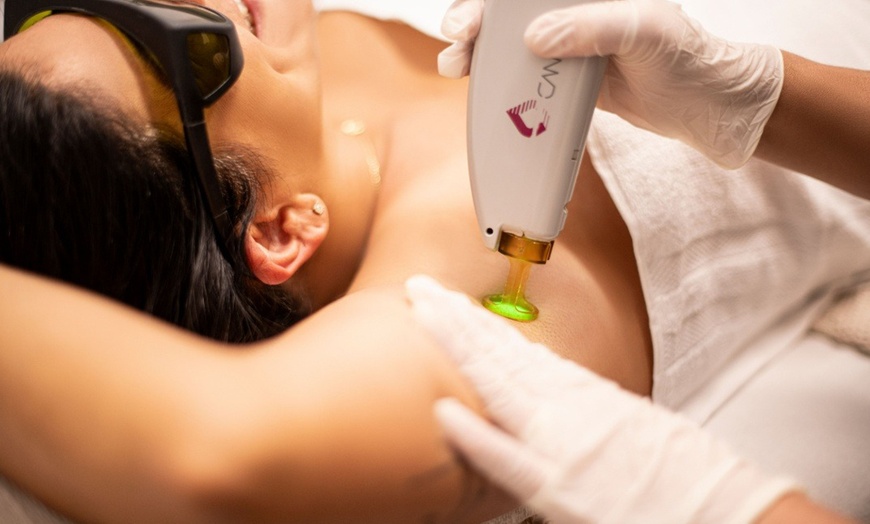Image 3: Up to 90% Off on Laser Hair Removal at Gentle Zap Laser Med Spa