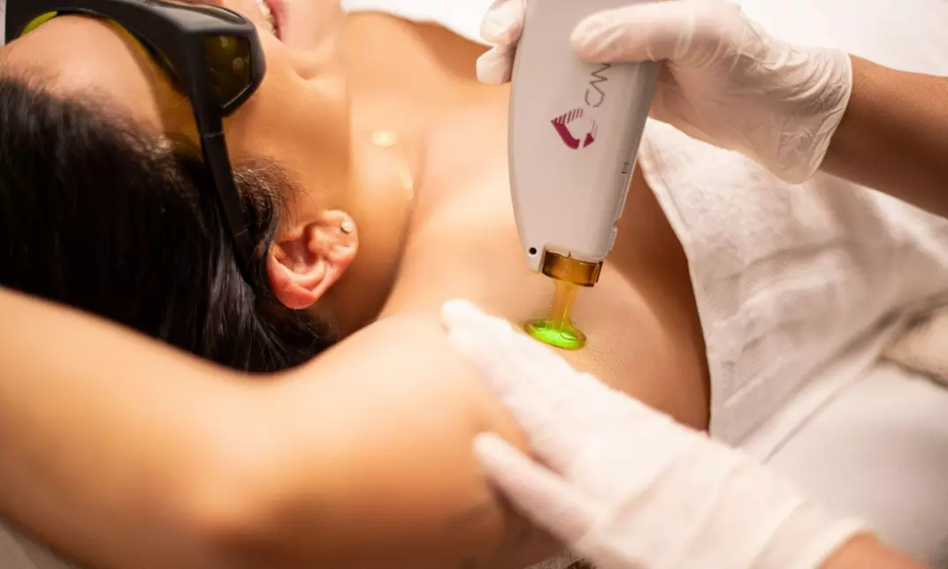Up to 89% Off on Laser Hair Removal at Gentle Zap Laser Med Spa