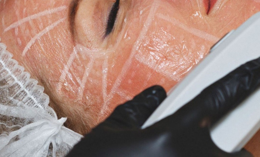 Image 2: Rejuvenate with One HIFU Treatment For Full Face, Neck or Both 