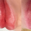 Image 6: Perfect Lips: Semi-Permanent Blush, Lip Liner & Dark Lip Correction
