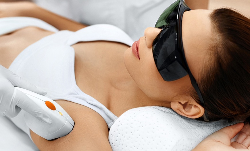 Image 1: Épilation laser SHR : aisselles, maillot ou jambes à Saint-Etienne