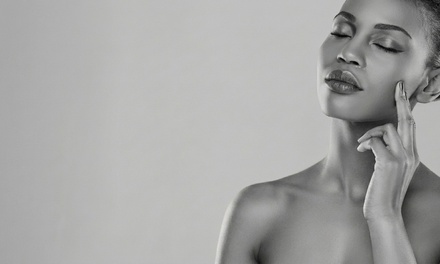 30-minute PCA Chemical Peel - Renu MedSpa - Chicago