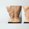 Image 3: One or Three Fat Reduction Treatments with Venus Bliss Max