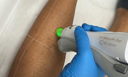 6 Sessions Small Area Laser Hair removal - Saverae Belle Laser Med Spa