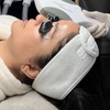 Image 1: One, Two or Three IPL Photo Facials w/ Enzyme Peel/ Microdermabrasion