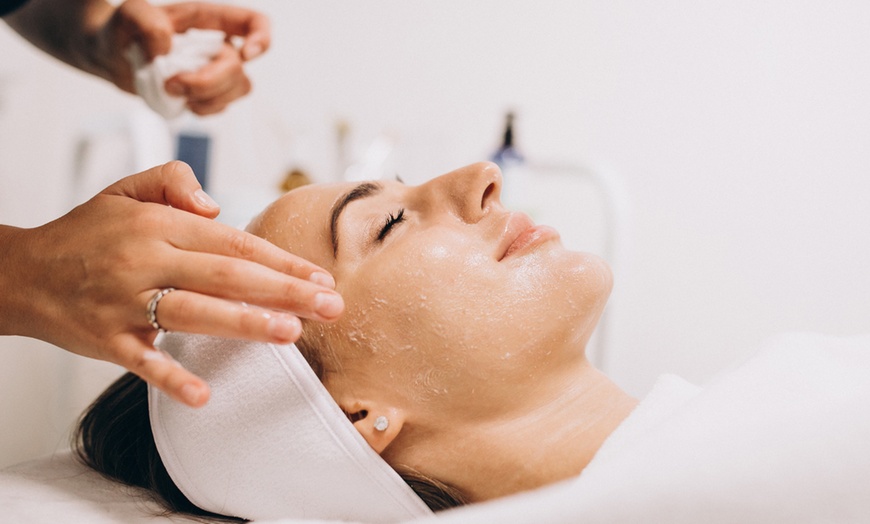 Image 2: Sesión de microneedling de labios o facial con activos hidratantes 