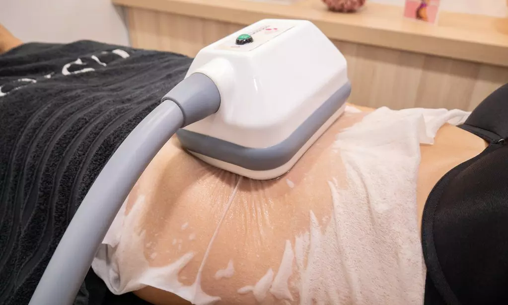 1 o 2 sesiones de criolipolisis en la Clínica Láser Fusión Raimundo