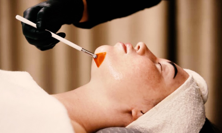 Image 1: Polynucleotide Under-Eye & Full-Face Rejuvenation Treatments