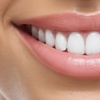 Image 4: Dental Check-Up + Hygienist Treatment, X-Ray & Home Teeth Whitening