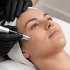 Image 3: Unlock Radiance with One, Two, or Three Micro needling Sessions