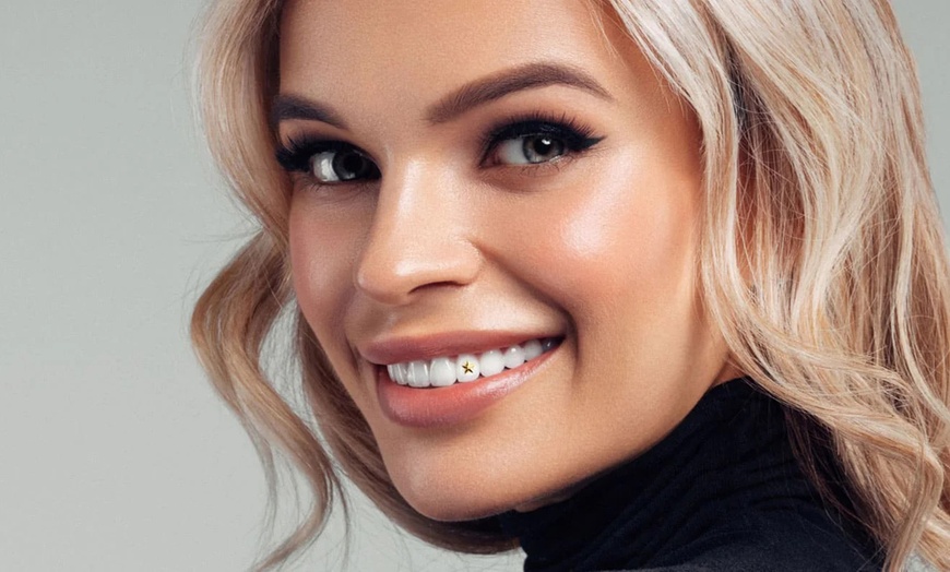 Image 2: Joyas dentales y revisión