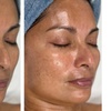 Image 1: Up to 55% Off on Facial - Chosen by Customer at Rise Skin Spa